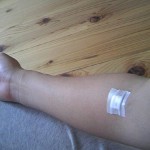arm1